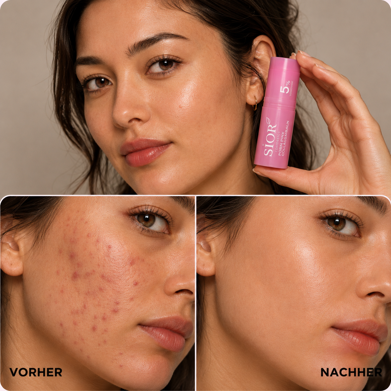 PDRN Volumen Balsam