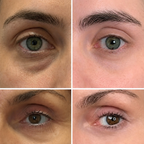 PDRN Volumen Balsam