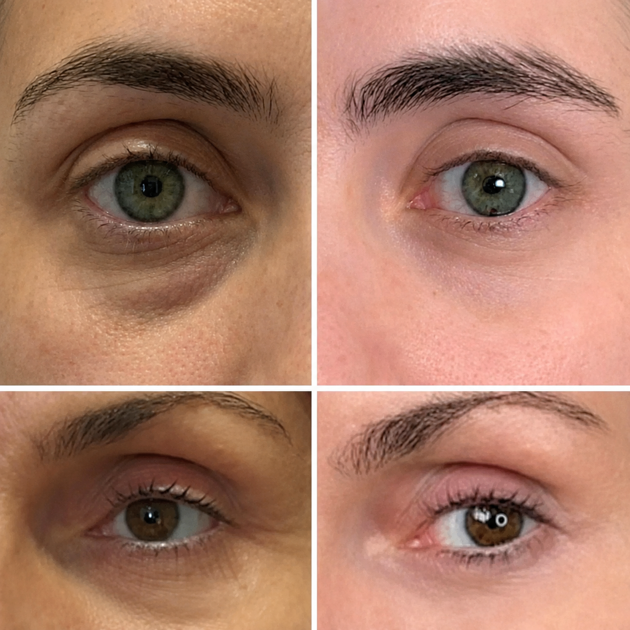 PDRN Volumen Balsam