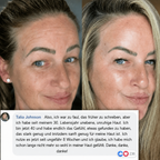 PDRN Volumen Balsam