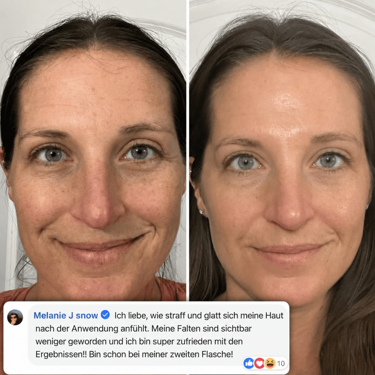 PDRN Volumen Balsam